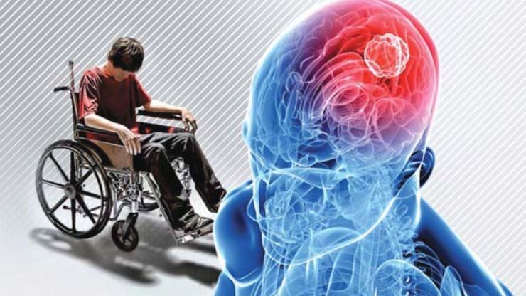 آیا ام‌اس با ورزش کنترل می‌شود؟