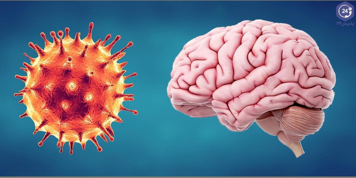 یافته جدید درباره ارتباط کرونا با زوال عقل