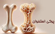 پوکی استخوان یک شبه درمان نمی‌شود