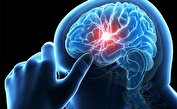 ابتلای ۱.۴ میلیون ایرانی به بیماری صرع