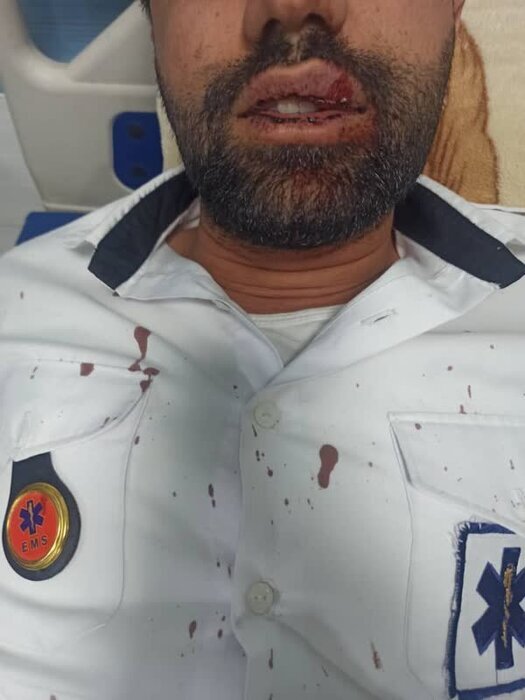 ضرب و شتم تکنسین اورژانس در چهارمحال وبختیاری ضرب و شتم تکنسین اورژانس در چهارمحال وبختیاری