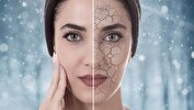 چند راهکار ساده برای پیشگیری از «خشکی پوست» در فصل پاییز