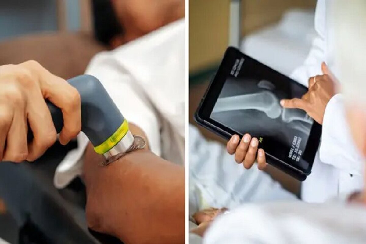 درمان شکستگی استخوان با یک اسلحه!