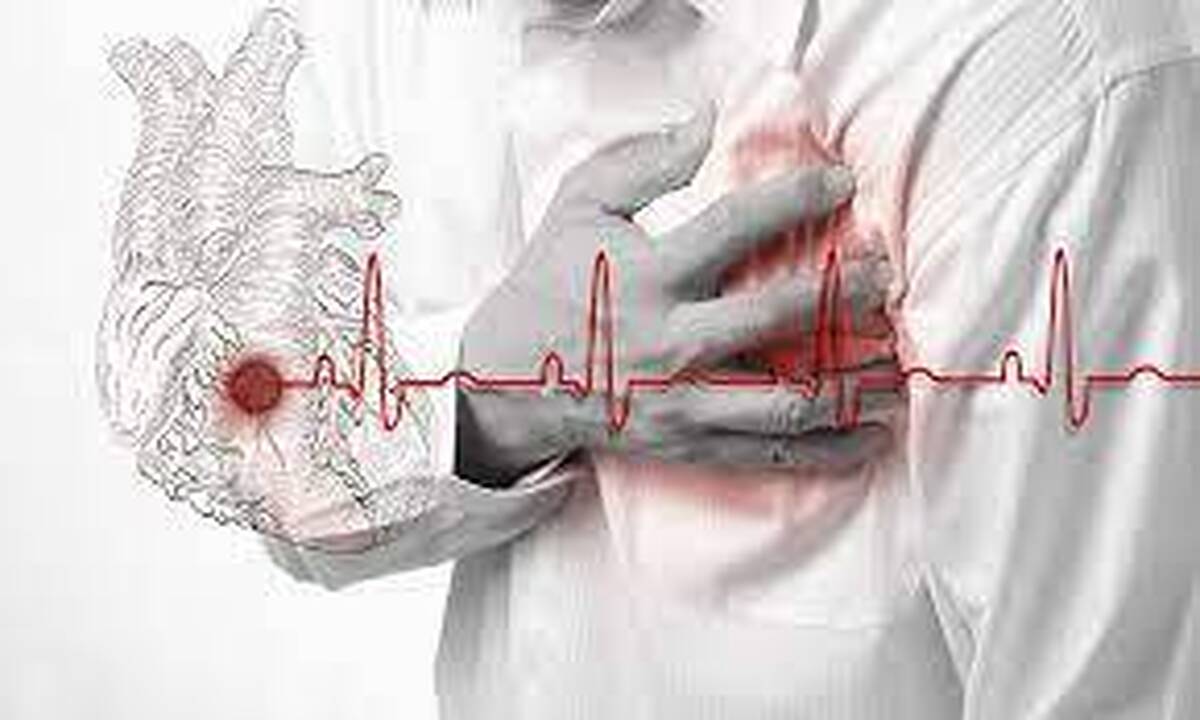 بیماری‌های قلبی‌عروقی عامل ۴۶ درصد از مرگ‌ها در ایران کاهش سن ابتلا به حمله سکته قلبی