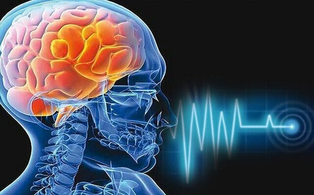 اولین اقدام اورژانسی در سکته مغزی