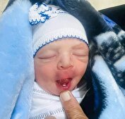 نوزاد عراقی با دندان به دنیا آمد